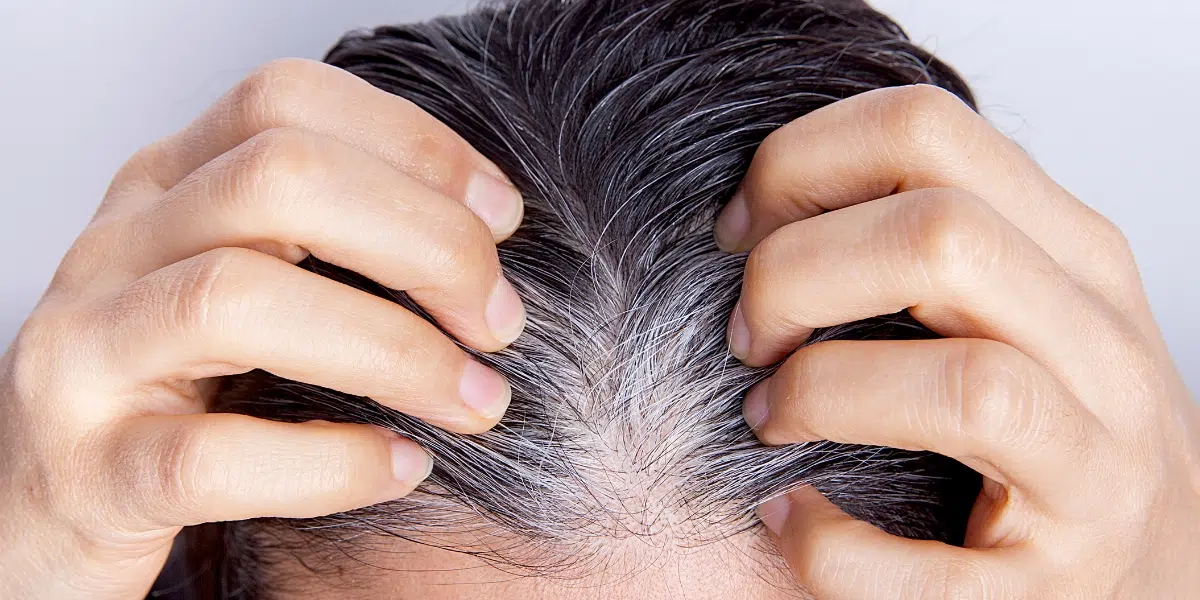 Stop ai capelli bianchi: i cibi miracolosi per combattere l’ingrigimento